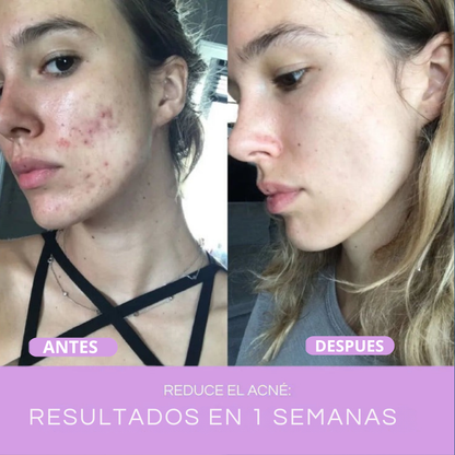 Orelix Glow Pro – Elimina Arrugas Y Rejuvenece en 7 Días